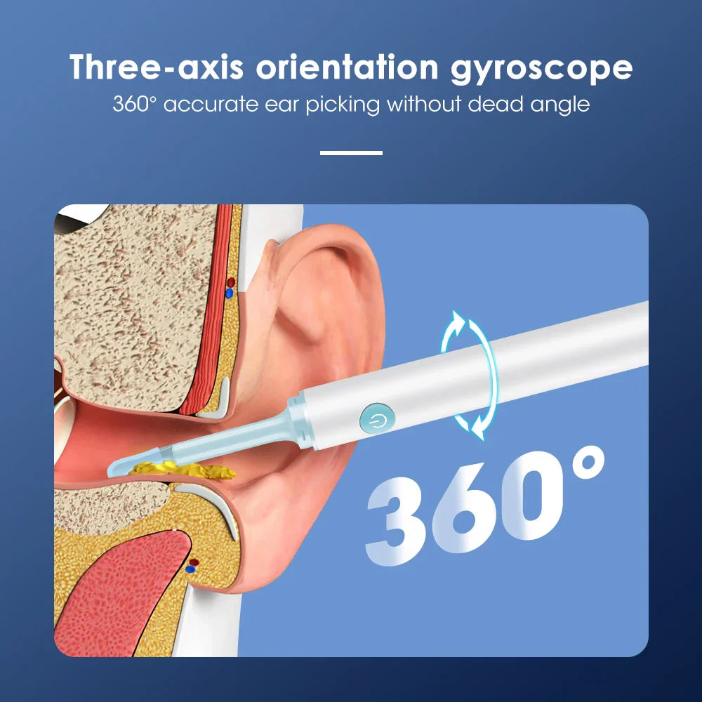 Intelligent Ear Wax Cleaner with 500MP Camera منظف الأذن الذكي بكاميرا 500