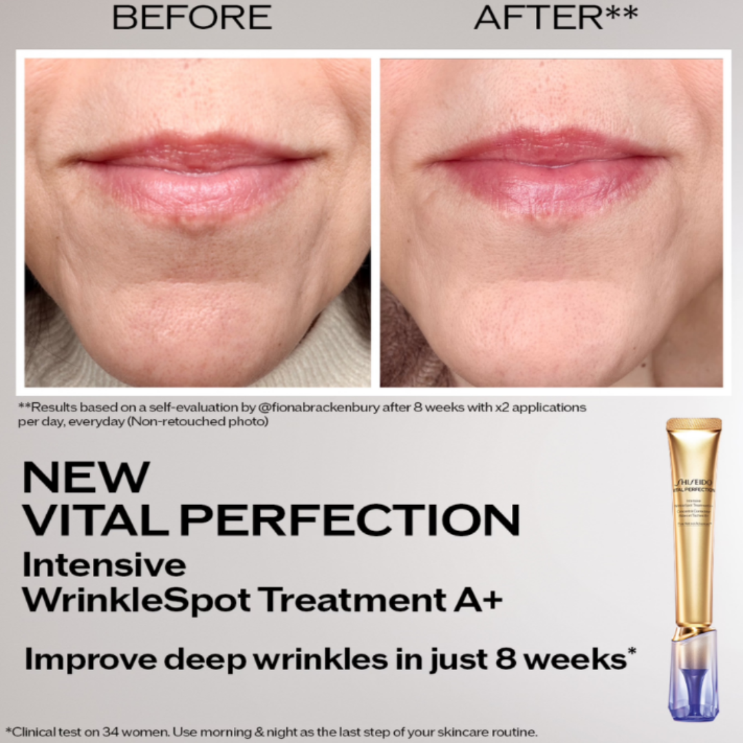 Shiseido Vital Perfection Intensive WrinkleSpot Treatment A+