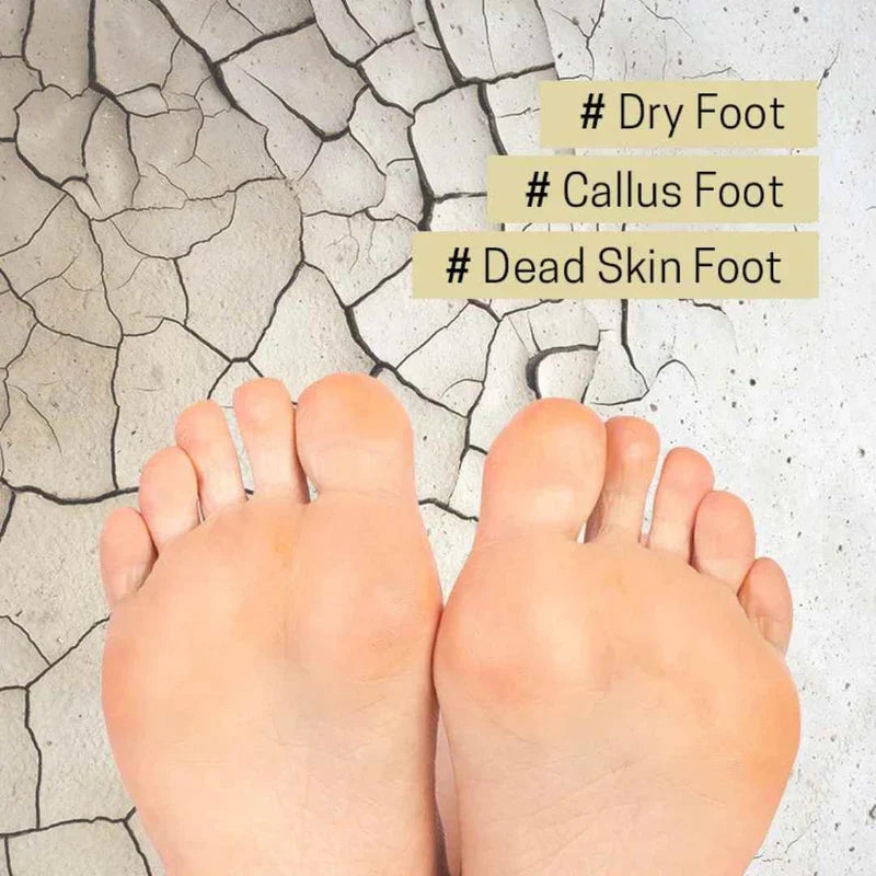 APIEU Soft Foot 30 Minute Peeling Socks