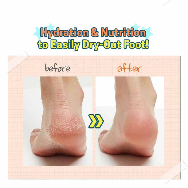 APIEU Soft Foot 30 Minute Peeling Socks