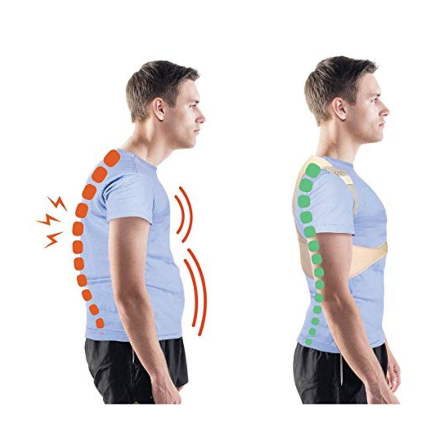 Posture Corrector