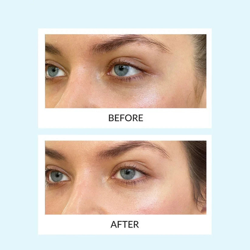 Reusable Eye Therapy Patch ( SOLO PATCH )