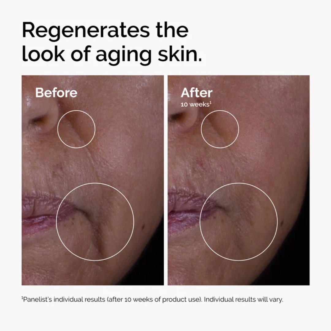 The Ordinary Gf 15% Solution Serum For Visible Skin Repair And Wrinkles - Medaid International