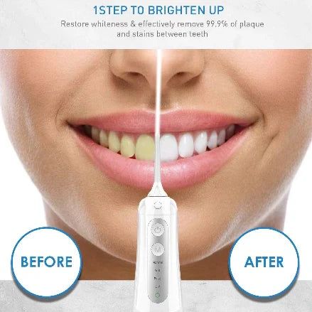 Dental Water Floss