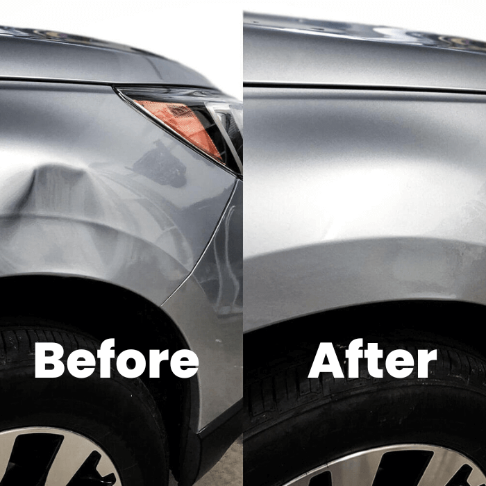 Car Dent Repair - Medaid International
