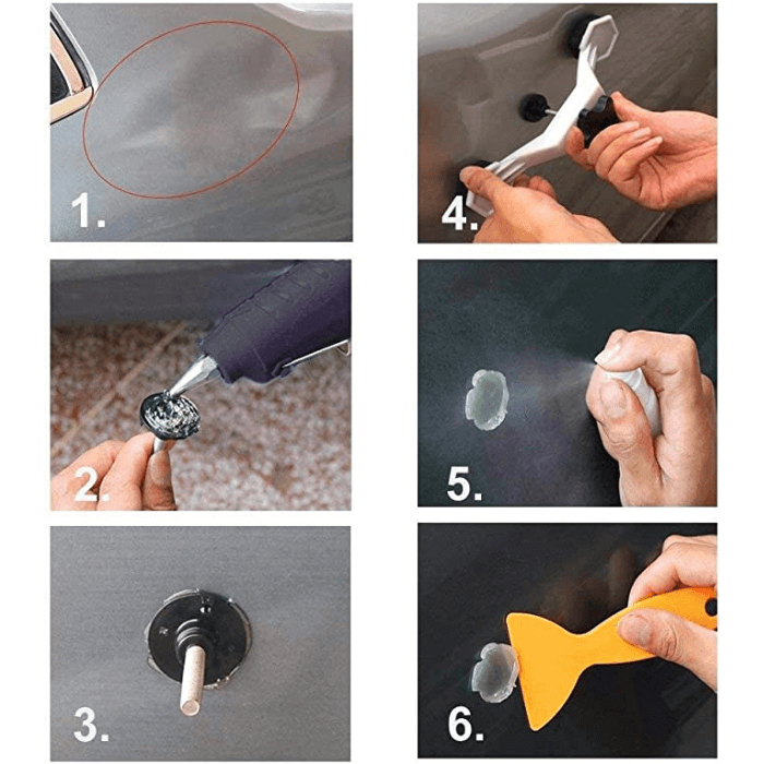 Car Dent Repair - Medaid International