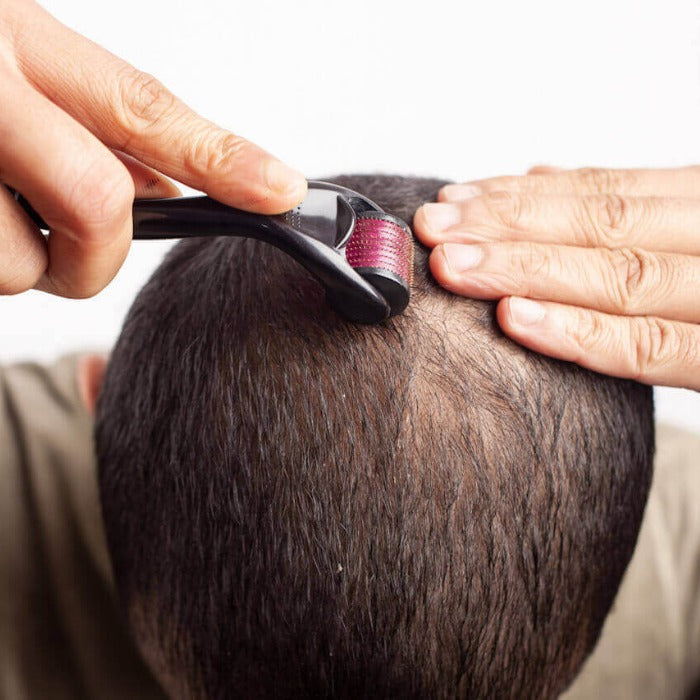 Hair Growth Derma Roller - Medaid International