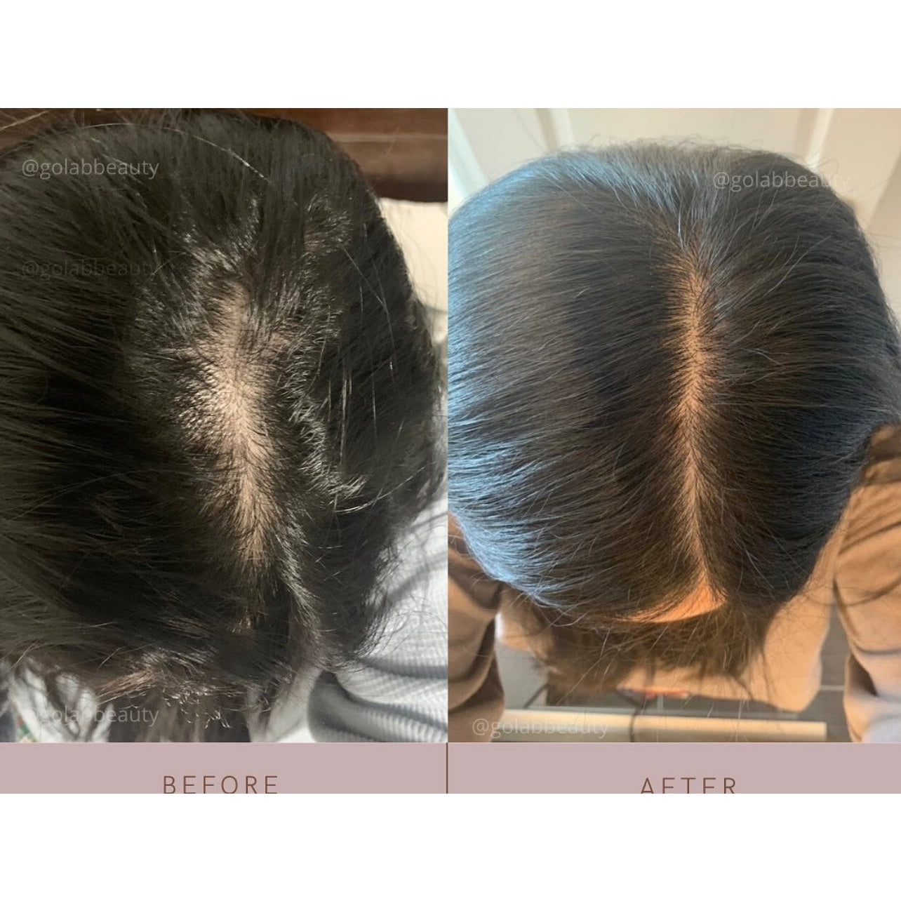 Strengthening Scalp Massage Oil - Medaid International