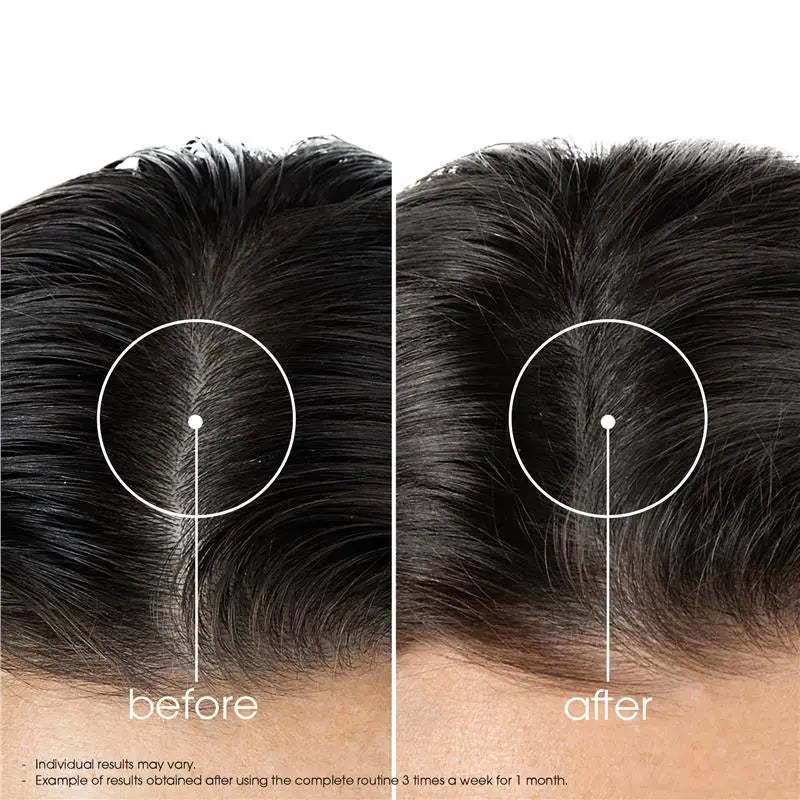 Quinine Conditioner