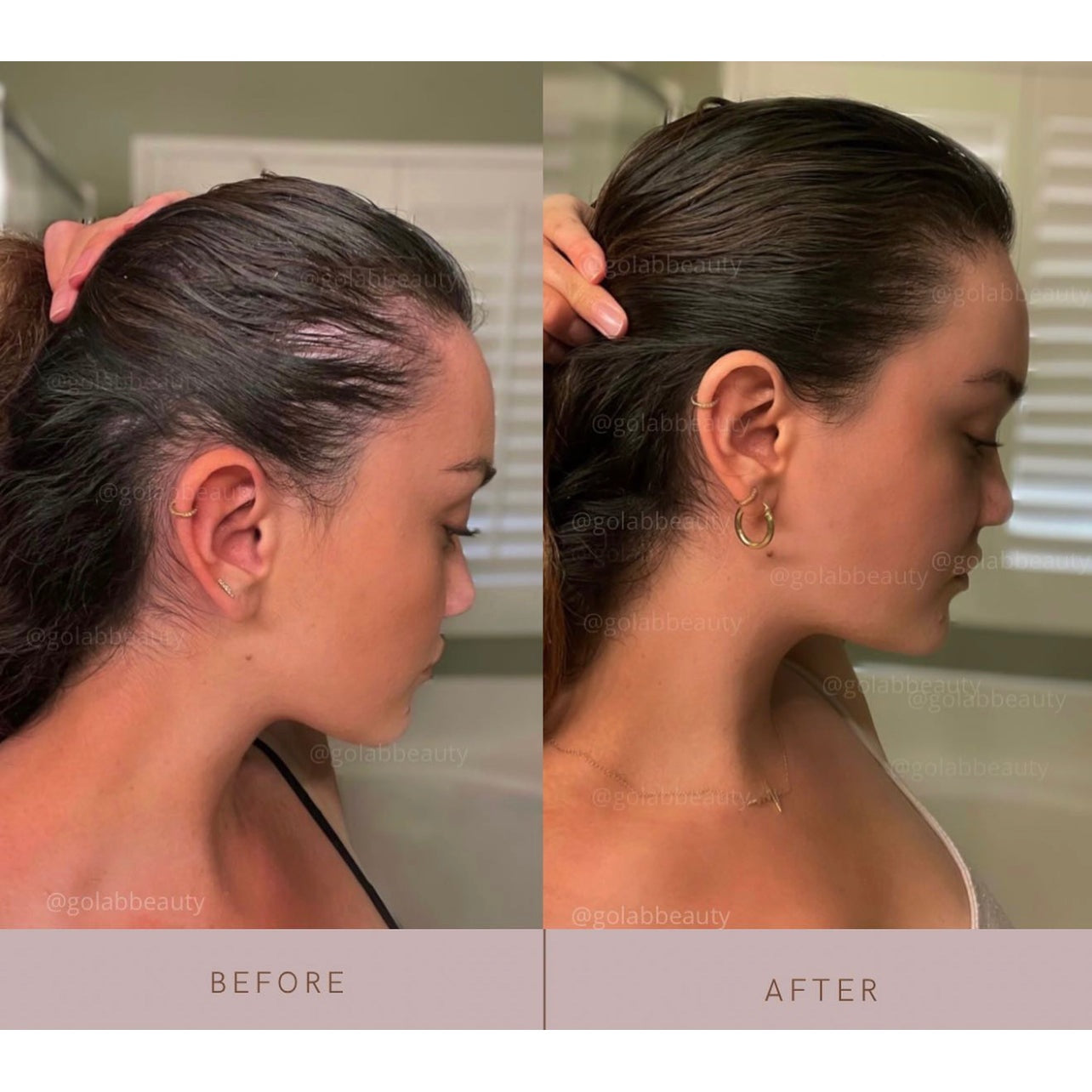 Strengthening Scalp Massage Oil - Medaid International