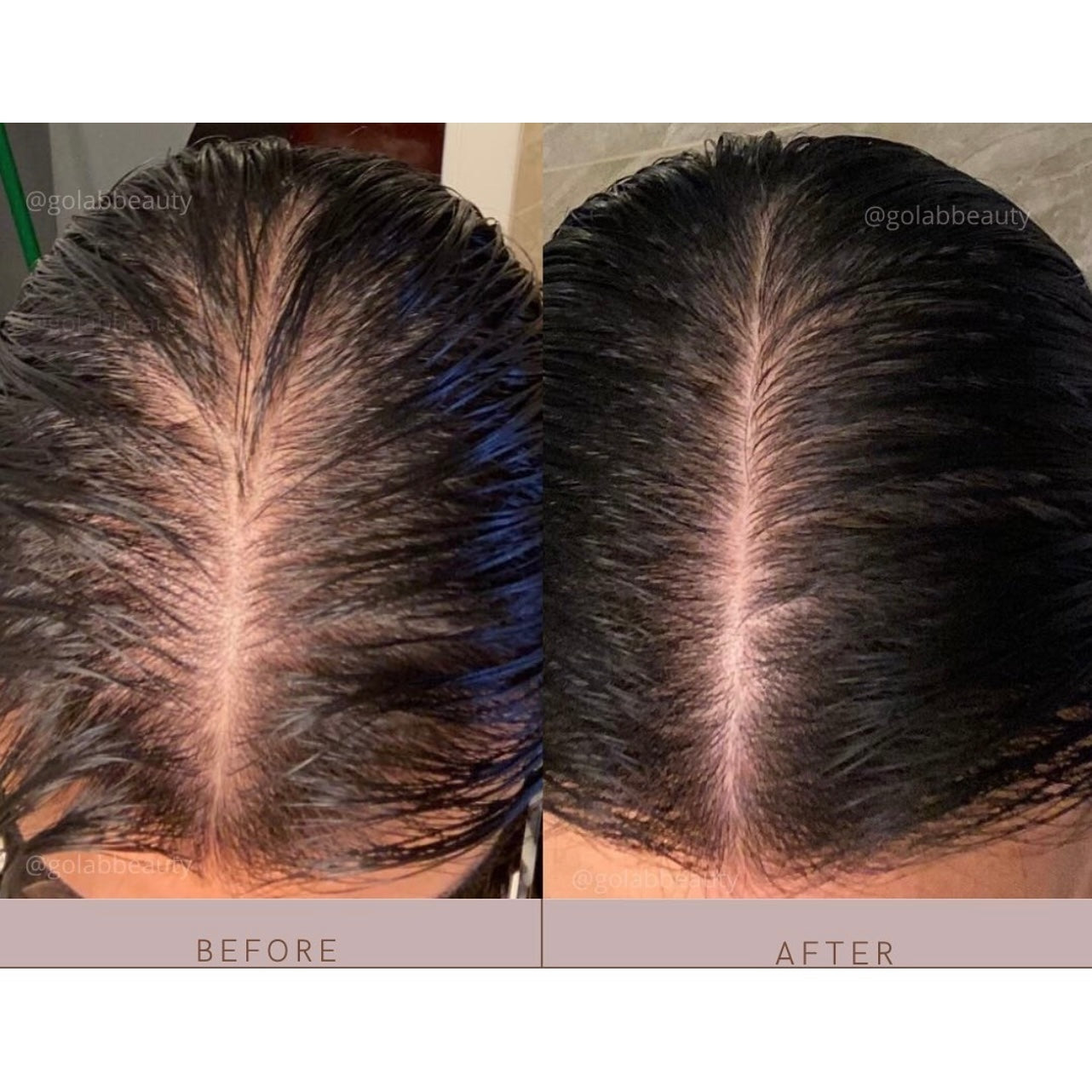 Strengthening Scalp Massage Oil - Medaid International