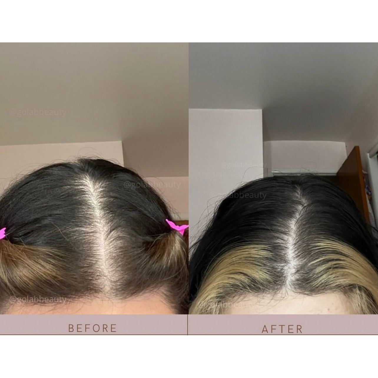 Strengthening Scalp Massage Oil - Medaid International