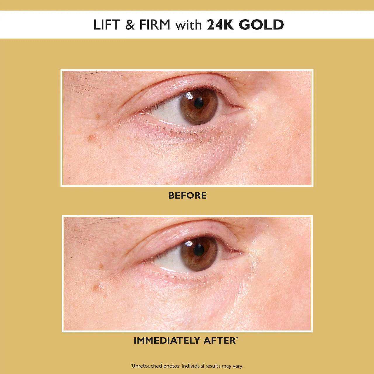 PETER THOMAS ROTH - 24K Gold Pure Luxury Lift & Firm EYE PATCHES | 30 pairs - 60 patches - Medaid International