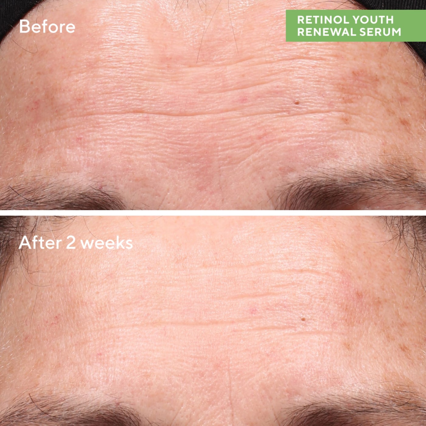 Murad - Retinol Youth Renewal Serum - Medaid International