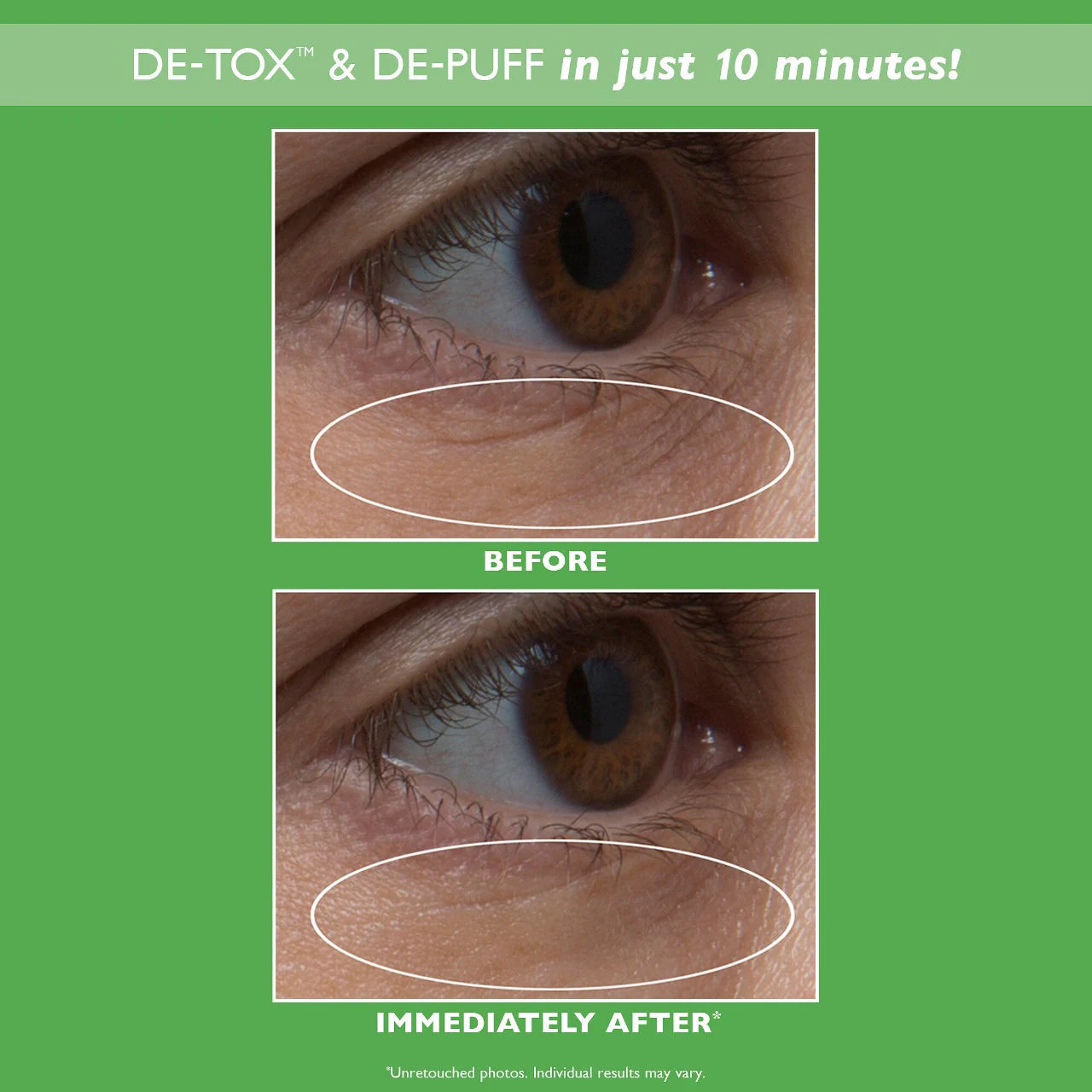 PETER THOMAS ROTH - CUCUMBER DETOX EYE PATCHES | 60 Pads-30 Treatments - Medaid International