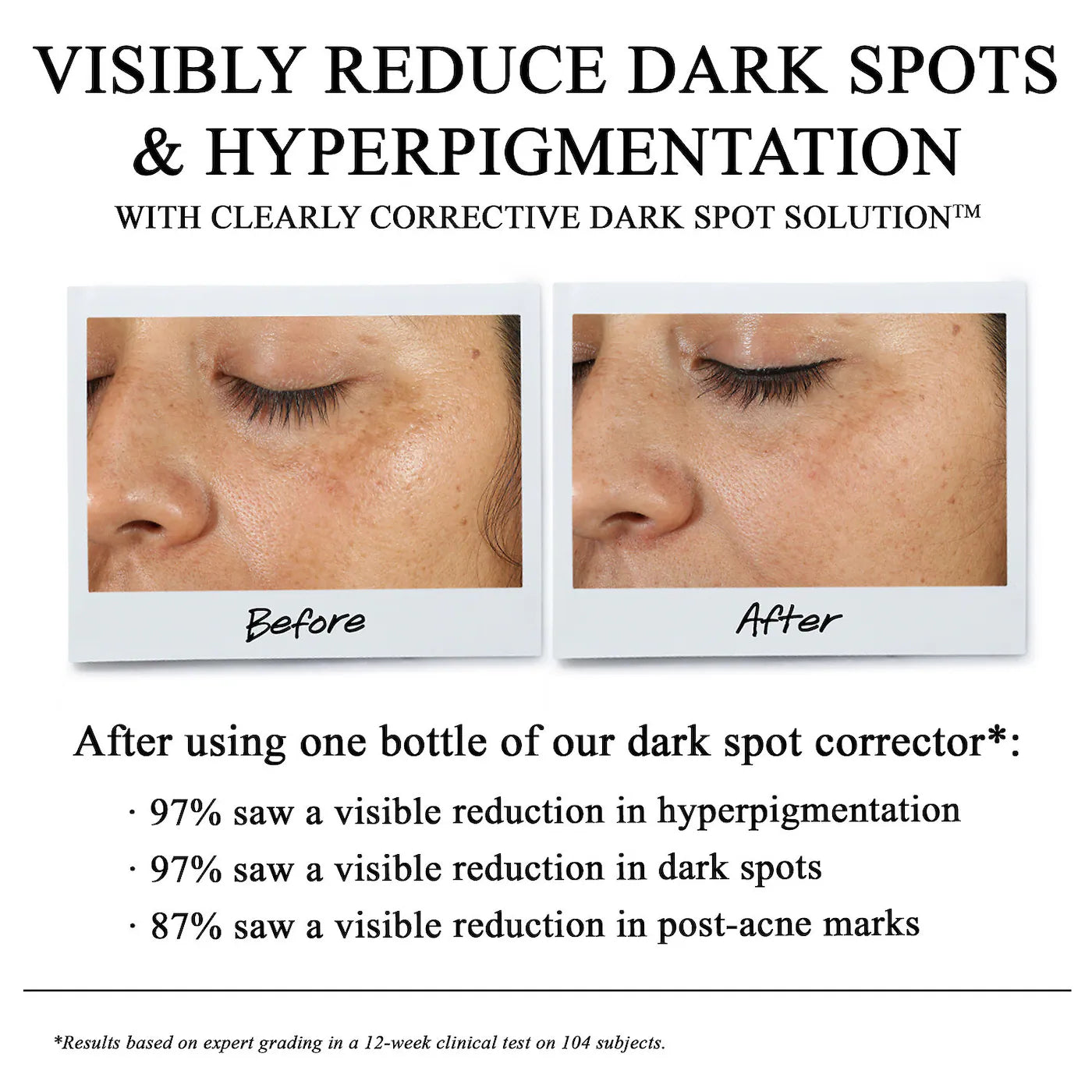 Kiehl's - Clearly Corrective Dark Spot Correcting Serum | 30 mL - Medaid International