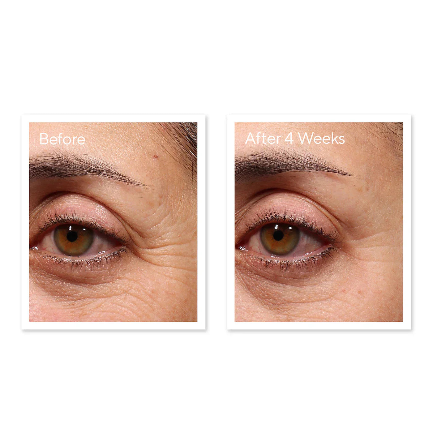 Murad - Retinol Youth Renewal Eye Serum | 15 ML - Medaid International