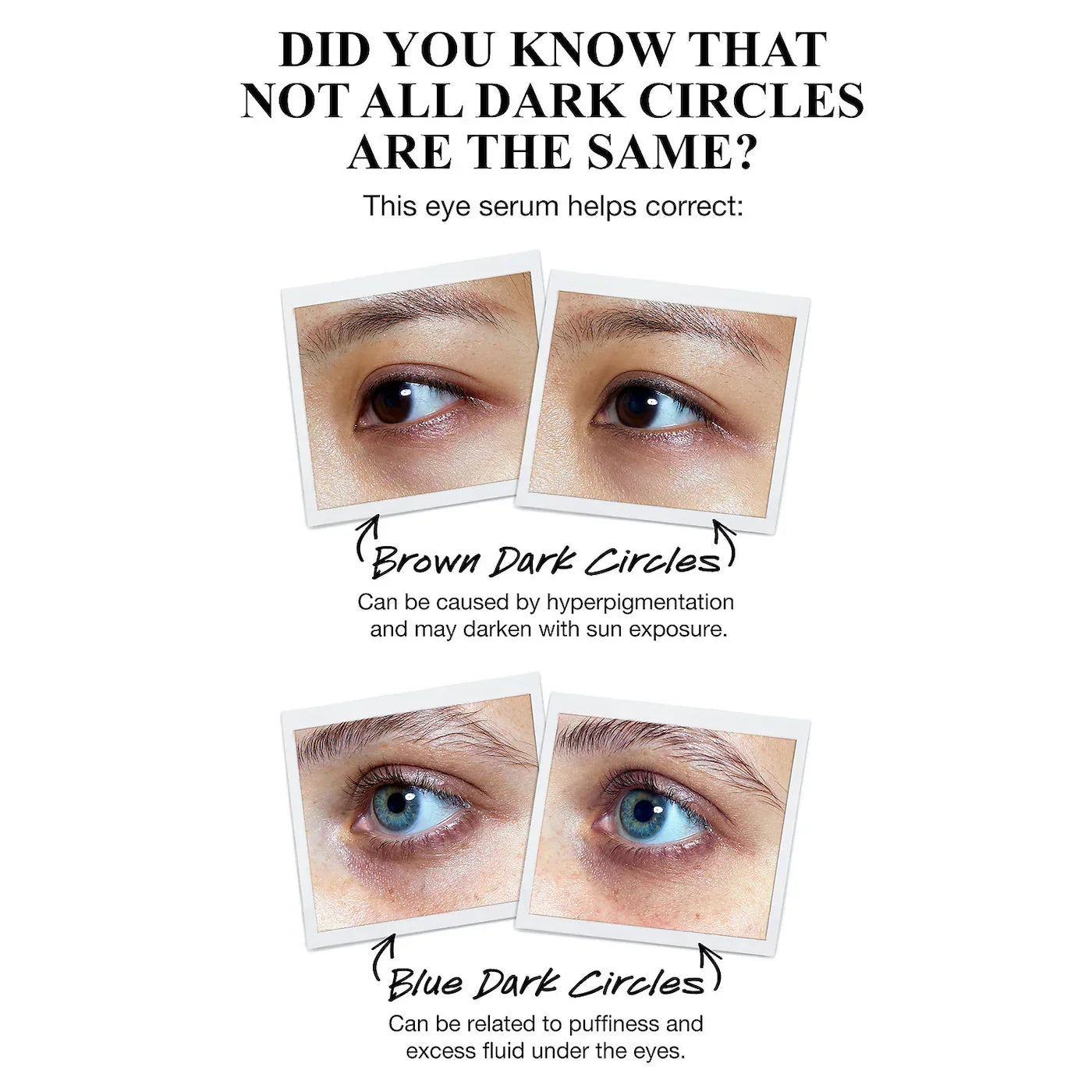 Kiehl's - Powerful-Strength Dark Circle Reducing Vitamin C Eye Serum | 15 mL - Medaid International