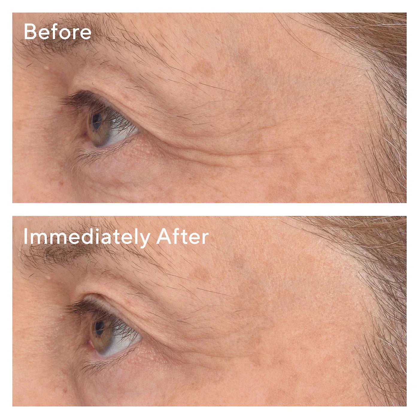 Murad - Retinol Youth Renewal Eye Masks | 1 Pair - Medaid International