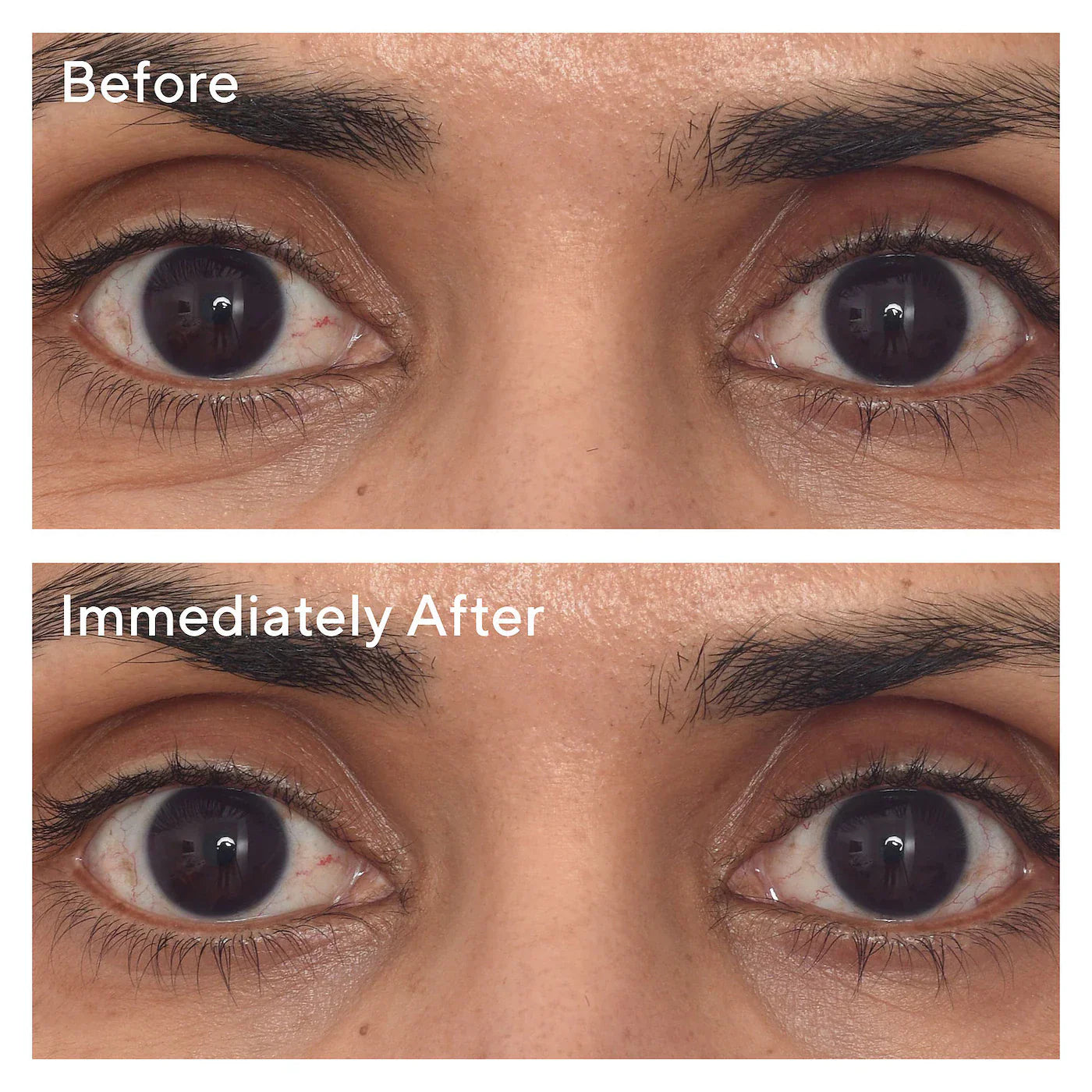 Murad - Retinol Youth Renewal Eye Masks | 1 Pair - Medaid International