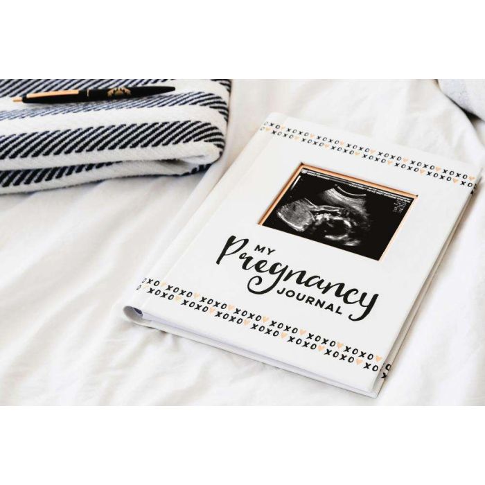 Pearhead - Pregnancy Journal - Black White & Gold