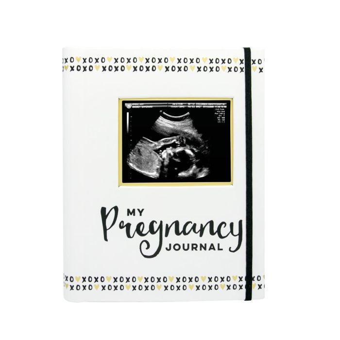Pearhead - Pregnancy Journal - Black White & Gold
