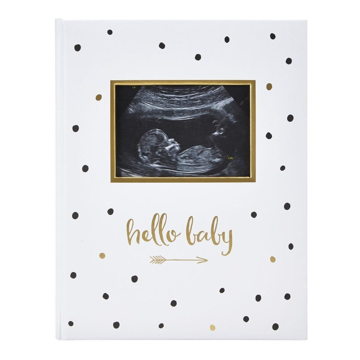 Pearhead - Baby Book - Black And Gold