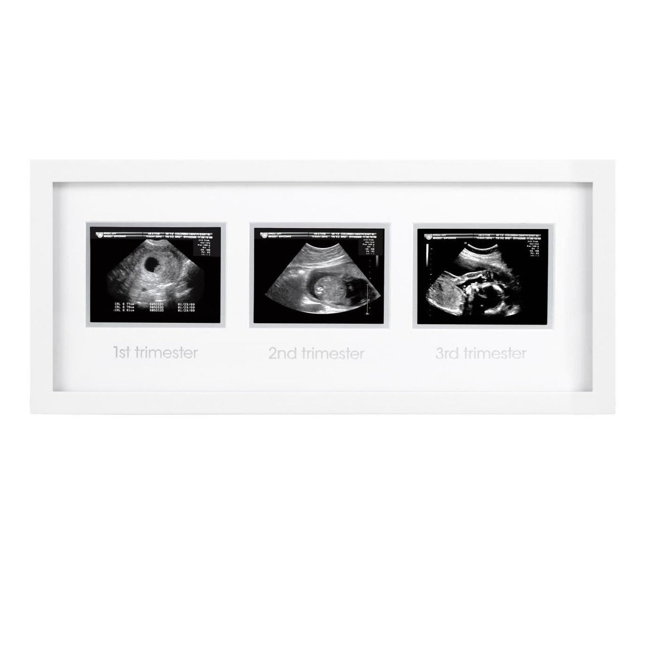 Pearhead - Triple Sonogram Frame