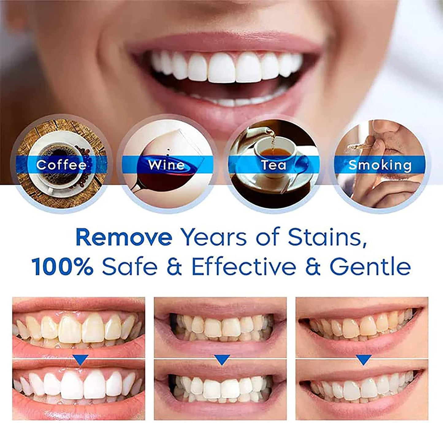 Teeth Whitening Pen