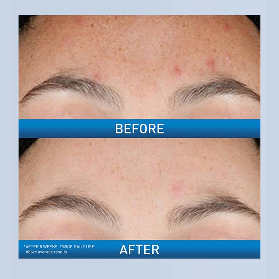Resurfacing Retinol Serum