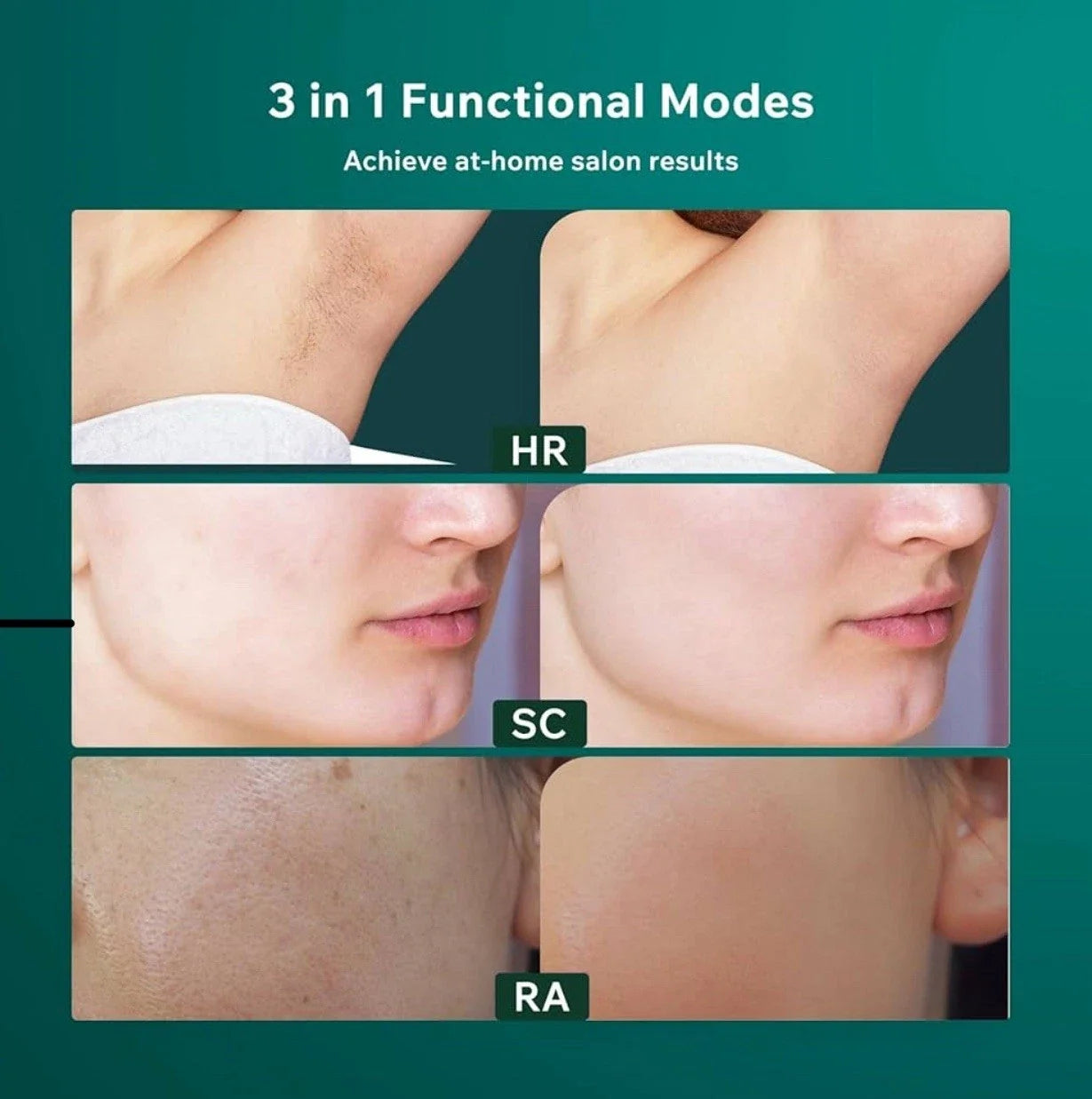 IPL Laser Hair Removal Device