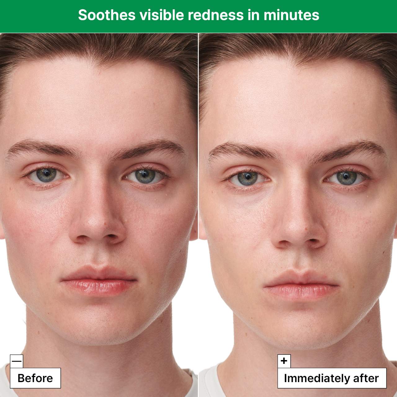 Dr. Jart+ - Cicapair ™ Sensitive Skin Serum Face Mask for Redness - Medaid International