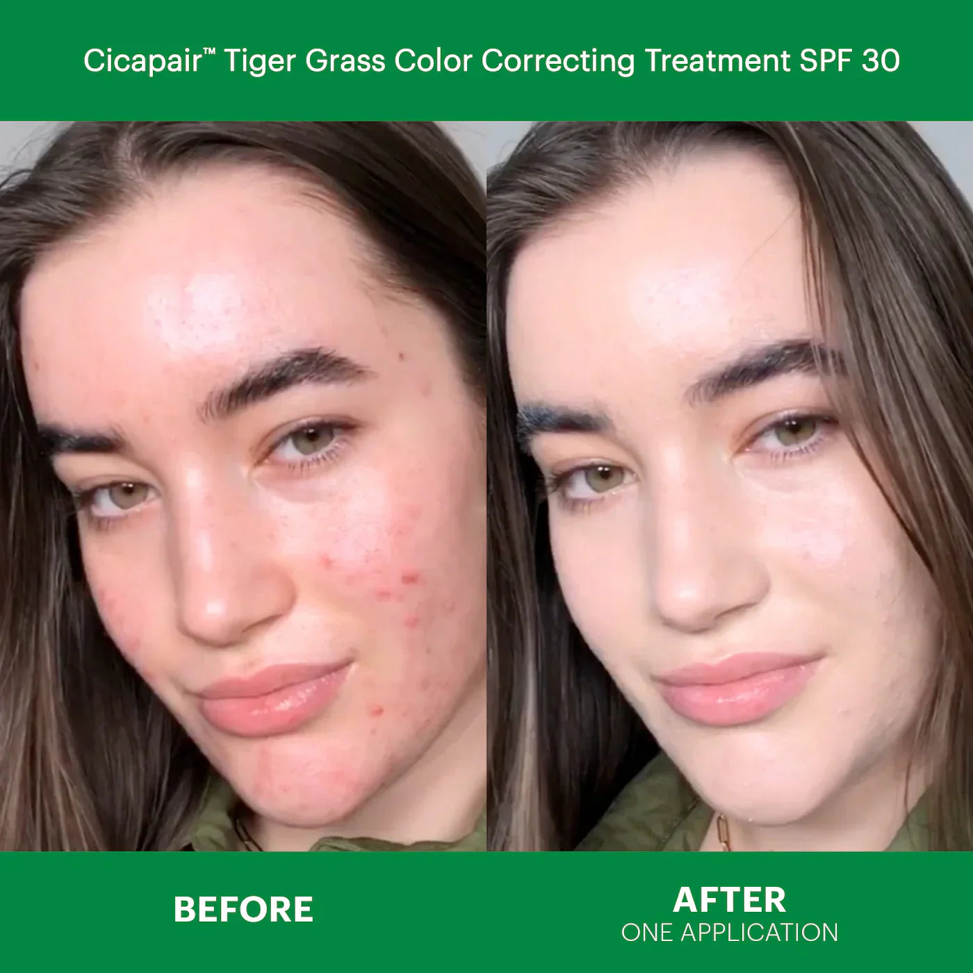 Dr. Jart+ - Cicapair™ Redness Rescue Kit for Sensitive Skin - Medaid International