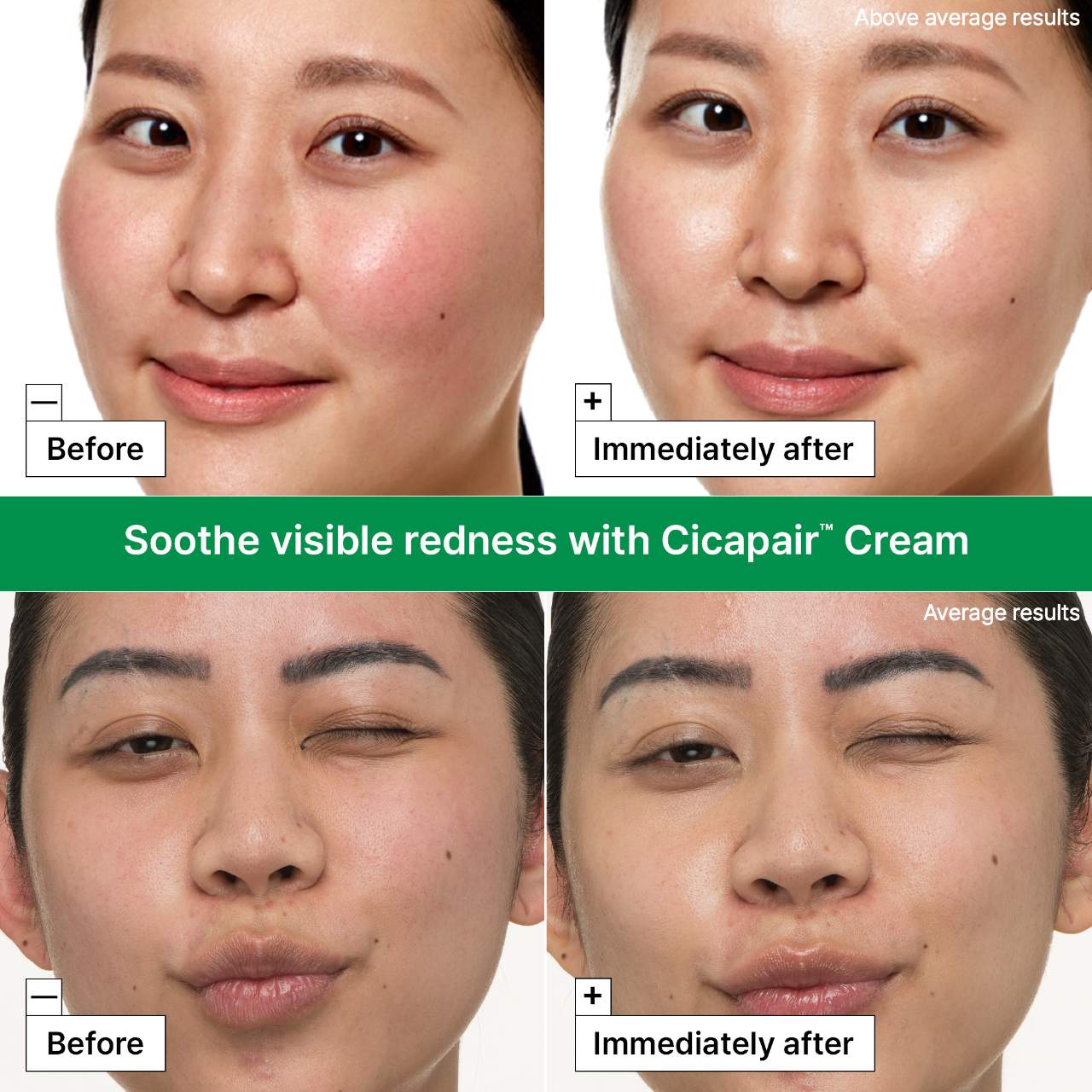 Dr. Jart+ - Cicapair™ Redness Rescue Kit for Sensitive Skin - Medaid International