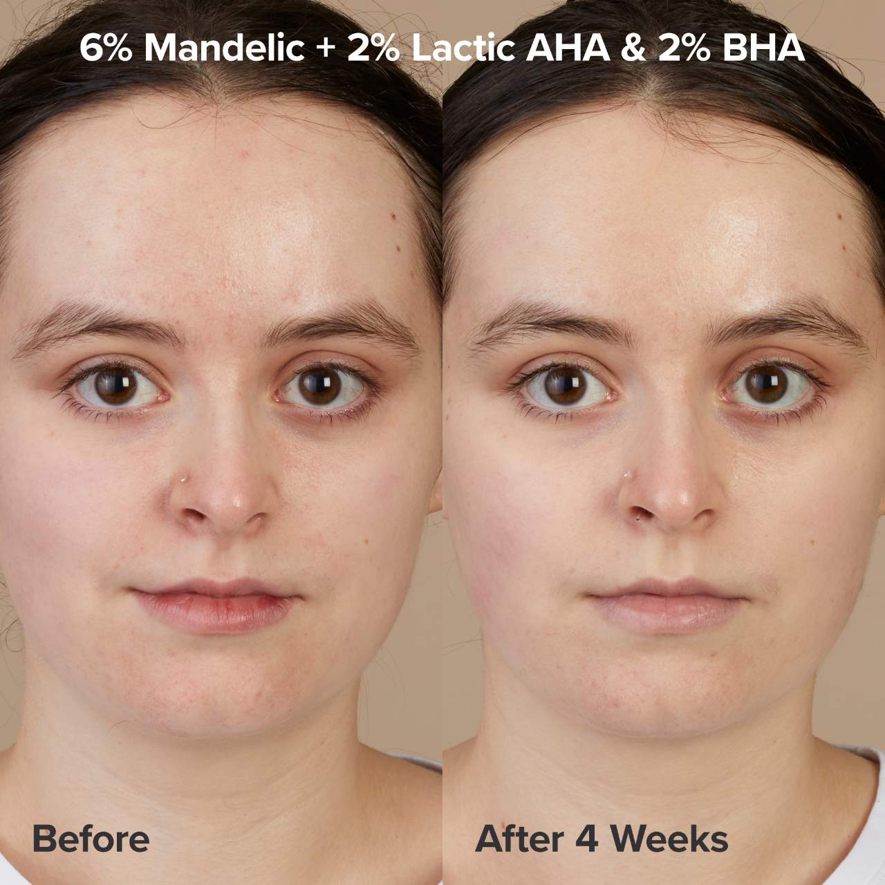 Paula's Choice - The Exfoliation Experience Kit with 2% BHA + 6% Mandelic Acid AHA - Medaid International
