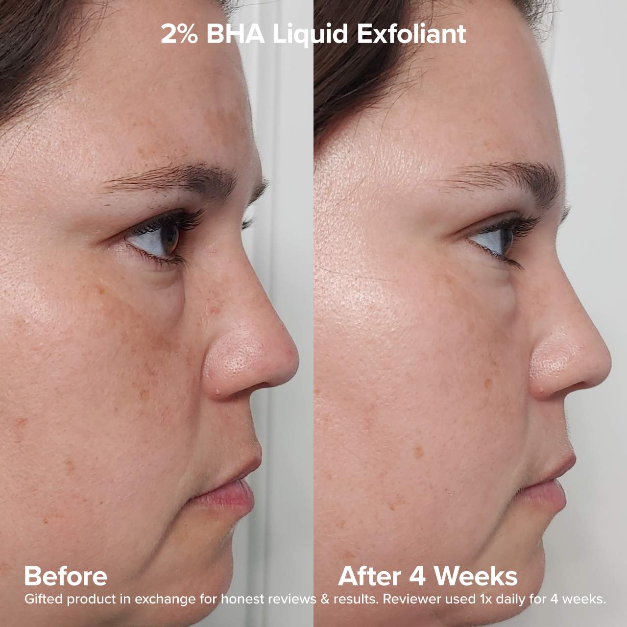 Paula's Choice - The Exfoliation Experience Kit with 2% BHA + 6% Mandelic Acid AHA - Medaid International