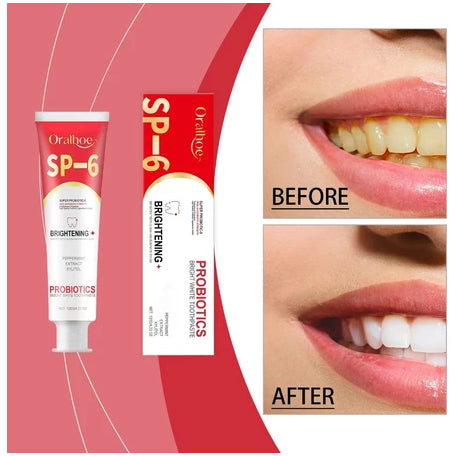 SP-6 Toothpaste Ultra Whitening معجون أسنان SP-6 فائق التبييض