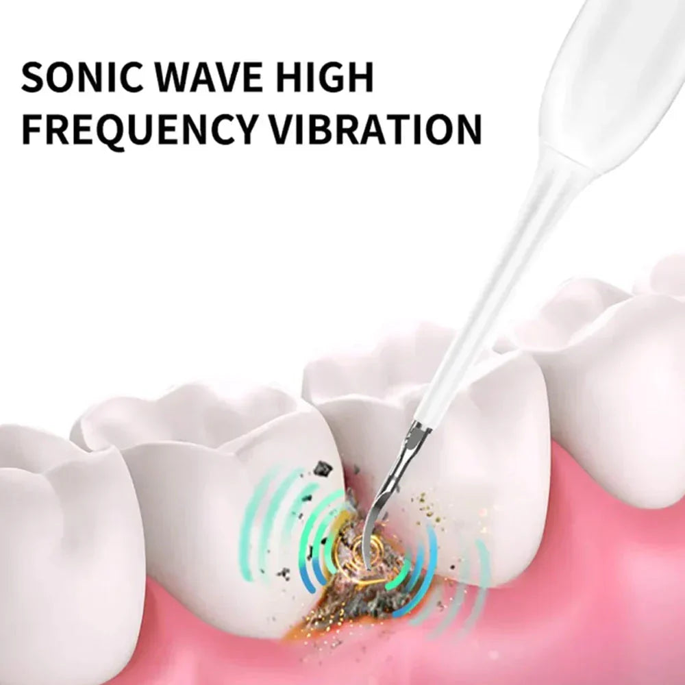 Electric Tooth Cleaner منظف أسنان كهربائي