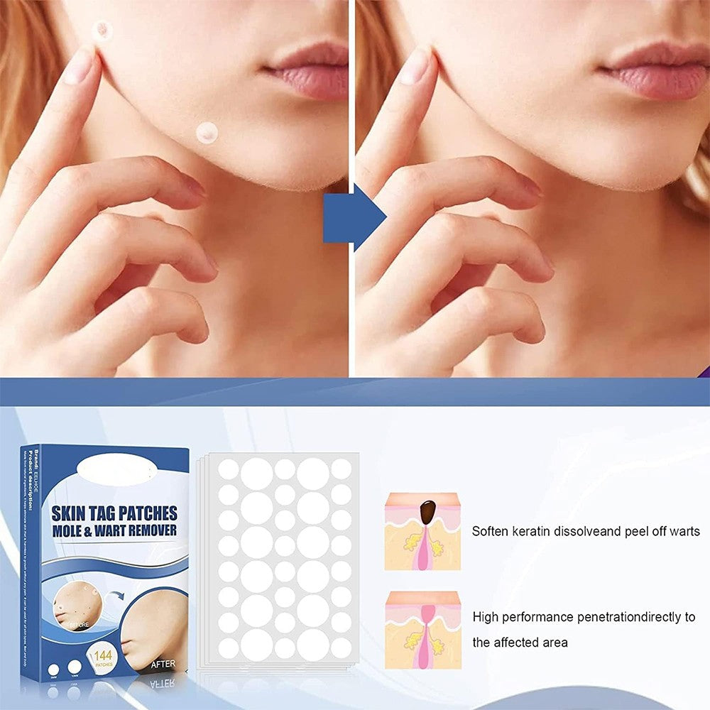 (net) Fast Skin Tag Removal Patch 144 Patches