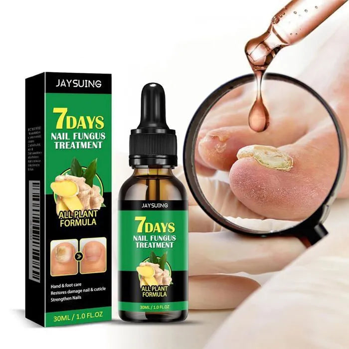 Ginger Nail Fungus Treatment Oil زيت علاج فطريات الأظافر بالزنجبيل