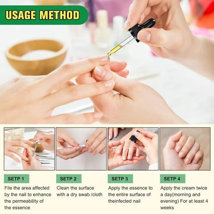 Ginger Nail Fungus Treatment Oil زيت علاج فطريات الأظافر بالزنجبيل