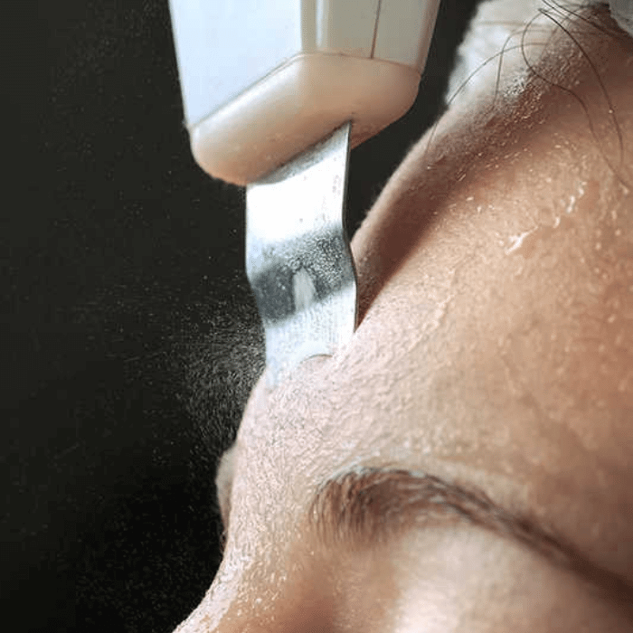 Ultrasonic Face Scrubber | Pore Purifier - Medaid International